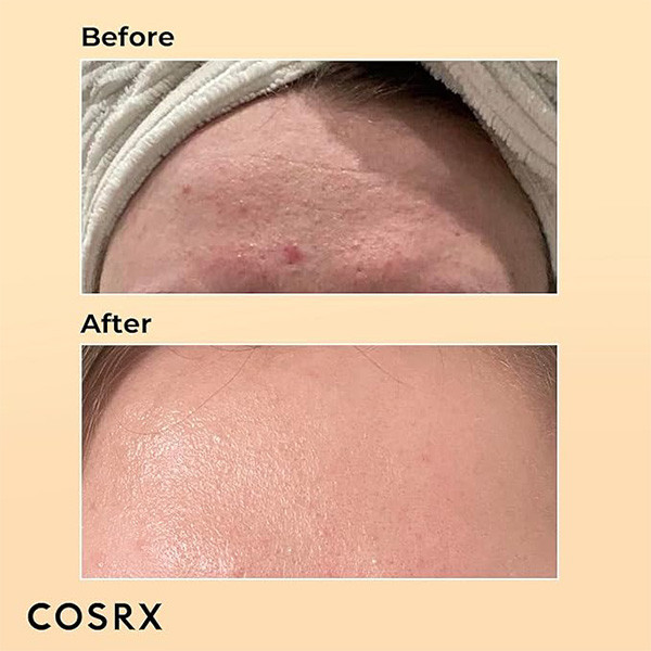 اسنس حلزون کوزارکس Cosrx Advanced Mucin Power Essence 100Ml