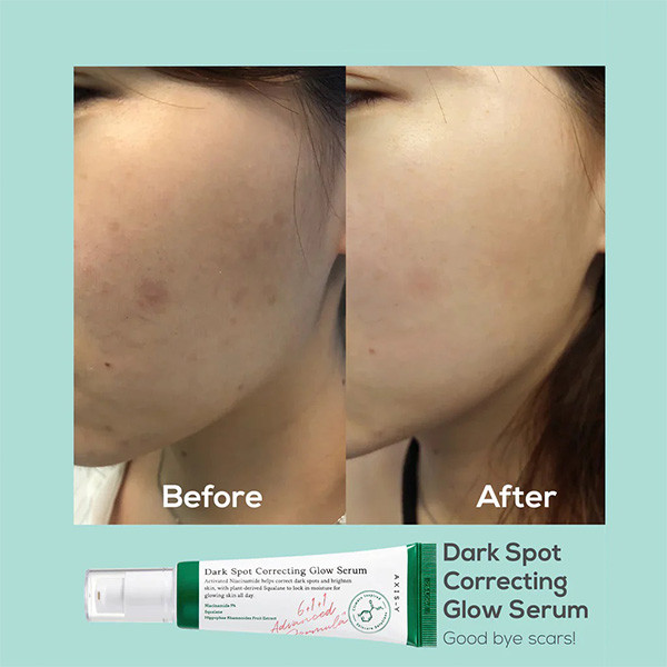 سرم ضد لک و روشن کننده اکسیس وای Axis Y Dark Spot Correcting Glow Serum 50Ml