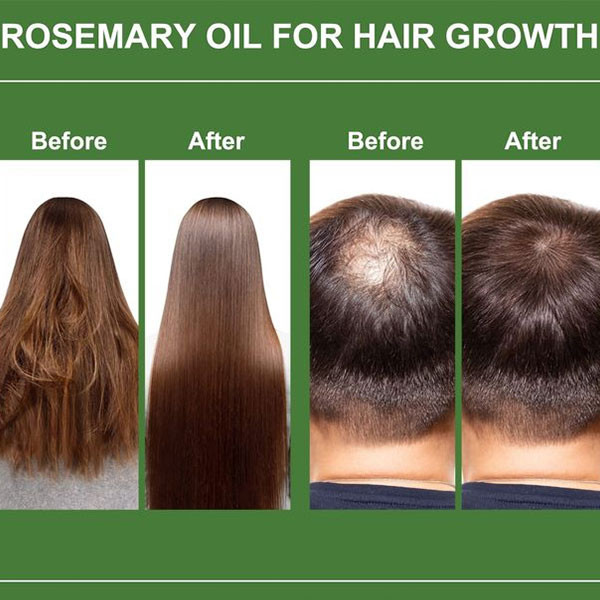 روغن مو ضد ریزش رزماری میله Mielle Rosemary Mint Sclap & Hair Strengthening Oil 59Ml