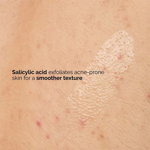 سرم بدن سالیسیلیک اسید اوردینری Ordinary Salicylic Acid 0.5% Body Serum 240Ml
